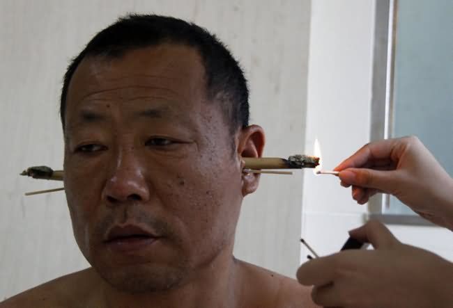 Can you tell the difference between Traditional Chinese Medicine (TCM) and fictional made up treatments? Take this quiz and find out how much you know today!